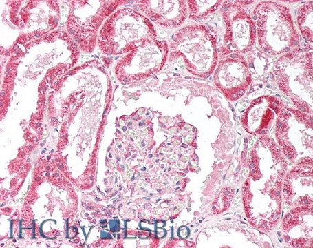 Anti-ORP5 (OBPH1) antibody produced in