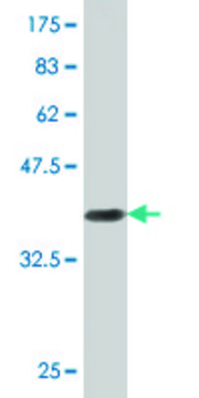 Monoclonal Anti-RIN2, (C-terminal) antibody produced