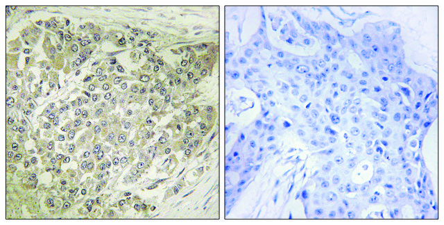 Anti-p70 S6 Kinase antibody produced