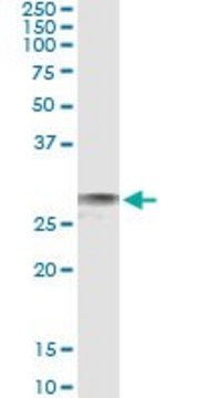 Monoclonal Anti-EXOSC3, (C-terminal) antibody produced