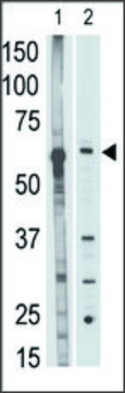 Anti-MMP25 (C-term) antibody produced in