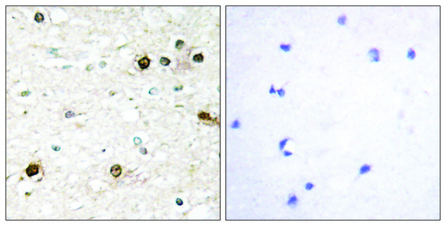 Anti-NAB2 antibody produced in rabbit
