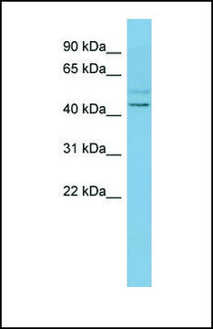 Anti-SLC46A1 antibody produced in rabbit