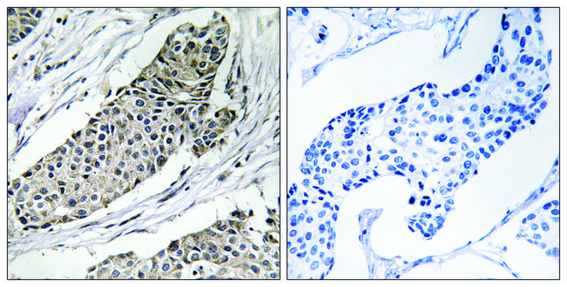 Anti-KCNAB3 antibody produced in rabbit
