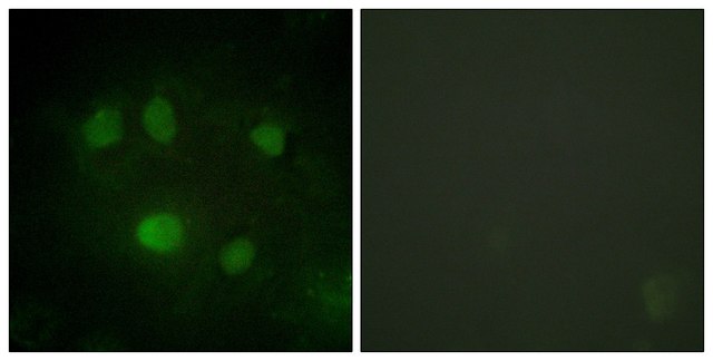 Anti-DDX5 antibody produced in rabbit