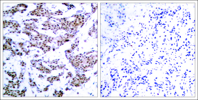 Anti-phospho-MEF2A (pThr³¹²) antibody produced in