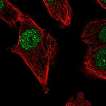 Anti-POLM antibody produced in rabbit