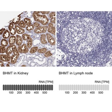 Anti-BHMT antibody produced in rabbit