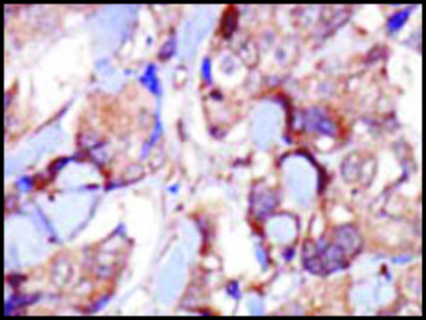 Anti-MLCK (N-term) antibody produced in