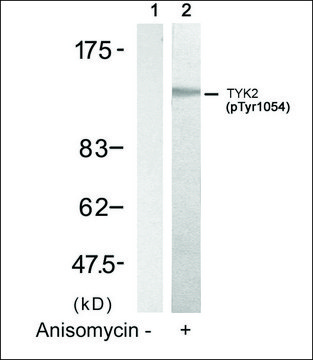 Anti-phospho-TYK2 (pTyr¹???) antibody produced in