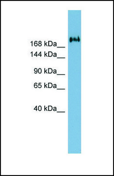 Anti-TMEM2 antibody produced in rabbit