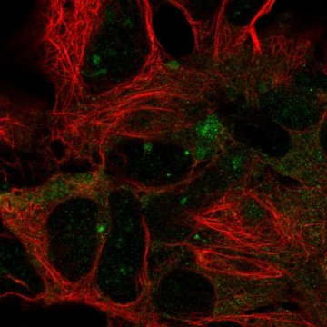 Anti-DYNC1LI2 antibody produced in rabbit