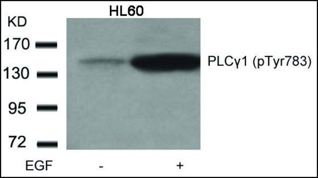 Anti-phospho-PLCG1 (pTyr??³) antibody produced in