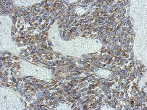 Anti-KCNG4 antibody produced in rabbit