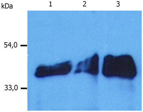 Monoclonal Anti-Cytokeratin 18 antibody produced