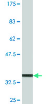 Monoclonal Anti-TREX1, (N-terminal) antibody produced