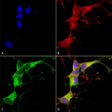 Monoclonal Anti-Ankyrin G antibody produced