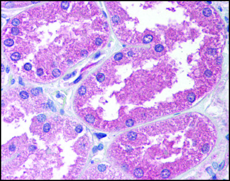 Anti-AADAT (AB1) antibody produced in