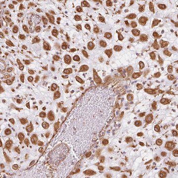 Anti-FOXR2 antibody produced in rabbit