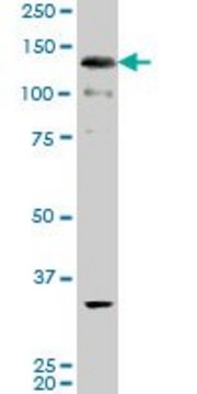 ANTI-ABL2 antibody produced in mouse
