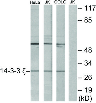 Anti-14-3-3 ? antibody produced in
