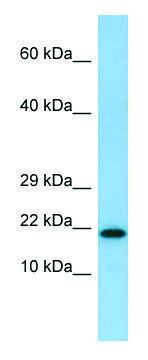 Anti-IL26 (N-terminal) antibody produced in