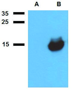 Anti-Acr1 (M. tuberculosis) antibody produced