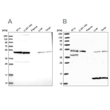 Anti-ST13 antibody produced in rabbit