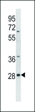 ANTI-ALKBH4 (CENTER) antibody produced in