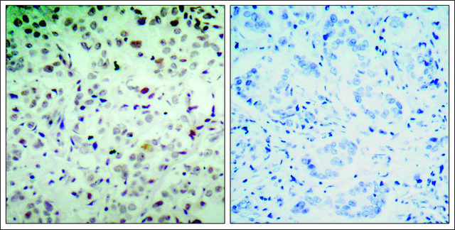Anti-phospho-RB1 (pSer???) antibody produced in