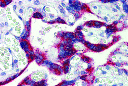 Anti-MKNK2 antibody produced in rabbit