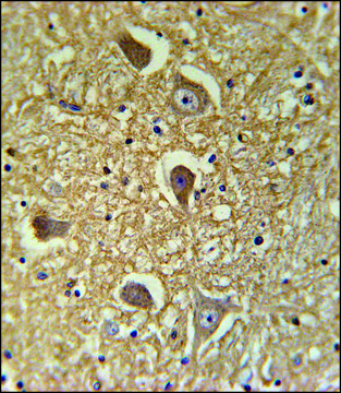 ANTI-HAS2 (CENTER) antibody produced in