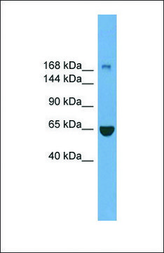 Anti-ZCCHC11 antibody produced in rabbit