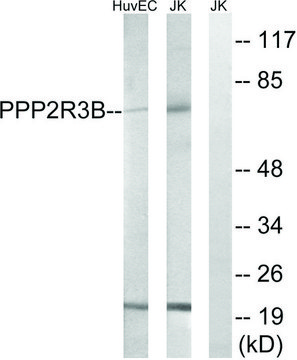 Anti-PPP2R5D antibody produced in rabbit
