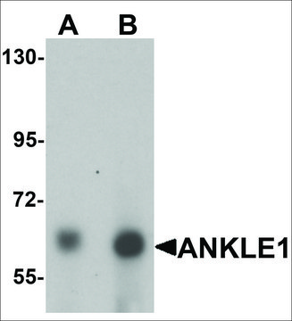 Anti-ANKLE1 antibody produced in chicken