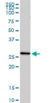 Anti-C1QC antibody produced in rabbit
