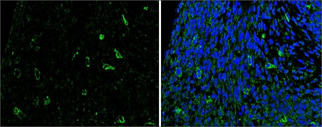 Anti-SLIT2 antibody produced in rabbit