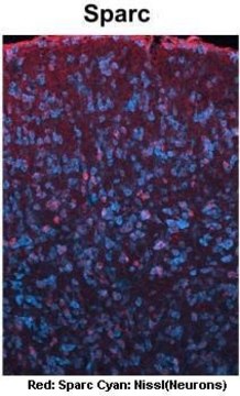 Anti-SPARC (C-terminal) antibody produced in