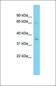 Anti-YTHDF1 antibody produced in rabbit