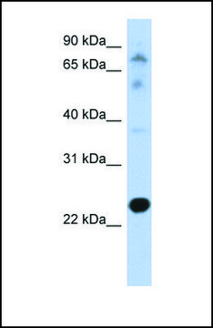 Anti-CHIC2, (N-terminal) antibody produced in