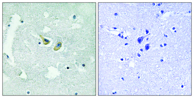 Anti-phospho-p47 phox (pSer³??) antibody produced