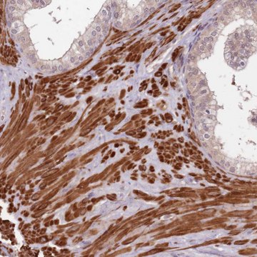 Anti-LIN37 antibody produced in rabbit