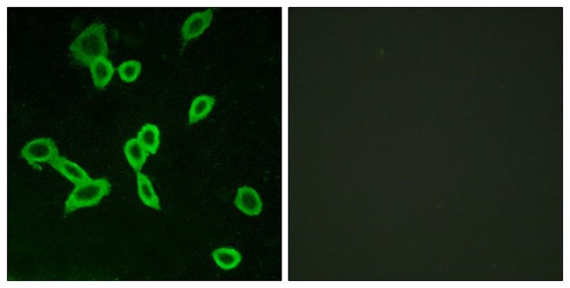 Anti-LGR6 antibody produced in rabbit