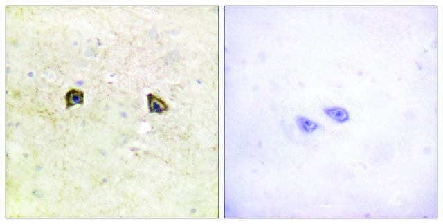 Anti-EPHB1 antibody produced in rabbit