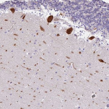 Anti-EEF1A1 antibody produced in rabbit
