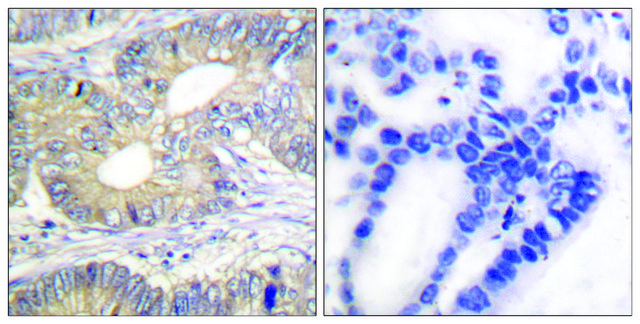 Anti-Somatostatin antibody produced in rabbit