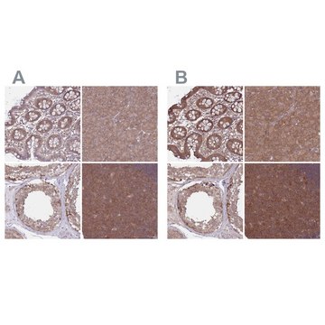 Anti-PFDN6 antibody produced in rabbit