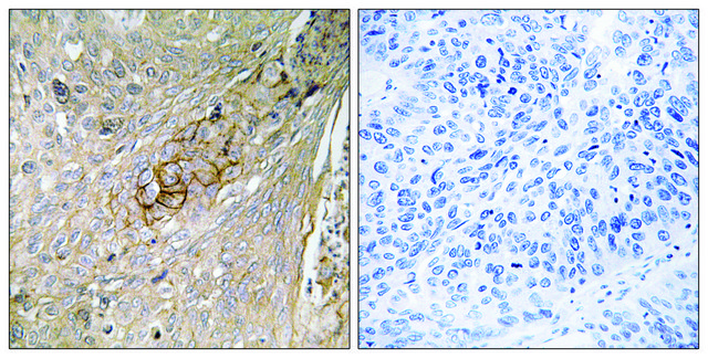 Anti-SLC6A6 antibody produced in rabbit