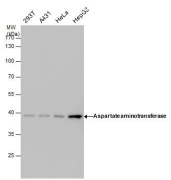 Monoclonal Anti-Aspartate aminotransferase antibody produced