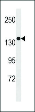 ANTI-SGSM1 (CENTER) antibody produced in